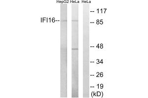 Western blot analysis of extracts from HeLa cells and HepG2 cells, using IFI16 antibody. (IFI16 Antikörper  (C-Term))