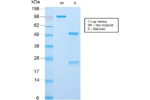SDS-PAGE Analysis Purified ACTH Rabbit Recombinant Monoclonal Antibody (CLIP/2859R). (Rekombinanter POMC Antikörper  (AA 25-39))