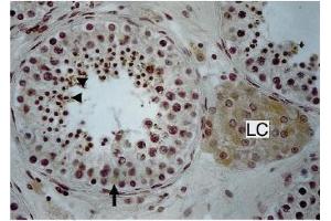 Immunohistochemistry image of Endothelin staining in paraffn sections of human testis. (Endothelin 1/2 Antikörper)