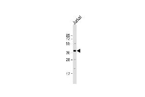 Anti-LEF1 Antibody (N-term) at 1:2000 dilution + Jurkat whole cell lysate Lysates/proteins at 20 μg per lane.