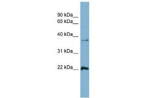 Ran antibody used at 1 ug/ml to detect target protein. (RAN Antikörper  (Middle Region))