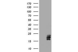 Image no. 1 for anti-Chorionic Gonadotropin, beta Polypeptide (CGB) (AA 21-165) antibody (ABIN1491188) (CGB Antikörper  (AA 21-165))