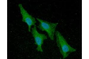 ICC/IF analysis of ACP1 in HeLa cells line, stained with DAPI (Blue) for nucleus staining and monoclonal anti-human ACP1 antibody (1:100) with goat anti-mouse IgG-Alexa fluor 488 conjugate (Green). (ACP1 Antikörper)