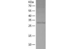 Western Blotting (WB) image for Upstream Transcription Factor 1 (USF1) (AA 1-310) protein (His tag) (ABIN7125657)