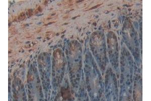 Detection of CPB2 in Mouse Intestine Tissue using Polyclonal Antibody to Carboxypeptidase B2 (CPB2) (CPB2 Antikörper  (AA 113-422))