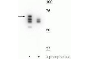 Western blot of T47D cell lysate treated with EGF (1 nM) for 60 minutes showing specific labeling of the ~70 kDa Hsp70 in the first lane (-). (HSP70 1A Antikörper  (pThr153))