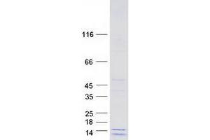 Validation with Western Blot (COX16 Protein (Myc-DYKDDDDK Tag))
