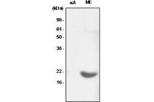 Recombinant crystallin alpha A (alphaA) and the extract of mouse eye (ME) were resolved by SDS-PAGE, transferred to PVDF membrane and probed with anti-human crystallin alpha B antibody (1:1,000). (CRYAB Antikörper  (AA 1-175))