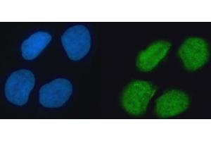 IF analysis of hnRNP K/HNRNPK using anti-hnRNP K/HNRNPK antibody (ABIN7601650). (HNRNPK Antikörper  (AA 40-463))