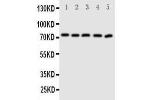 Western Blotting (WB) image for anti-ATP-Binding Cassette, Sub-Family G (WHITE), Member 5 (ABCG5) (AA 116-131), (N-Term) antibody (ABIN3044097)