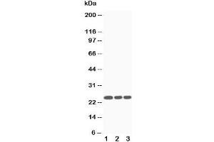 Western blot testing of SOCS3 antibody and Lane 1:  Jurkat;  2: CEM;  3: Raji cell lysate