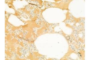 ABIN6265573 and ABIN6272896 at 1/100 staining human normal lung tissue by IHC-P. (TIMM23 Antikörper  (N-Term))