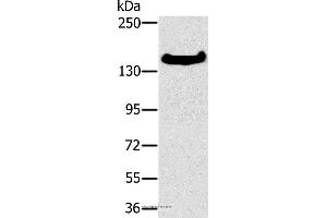Western blot analysis of A172 cell, using FMNL1 Polyclonal Antibody at dilution of 1:350 (Formin-Like 1 Antikörper)