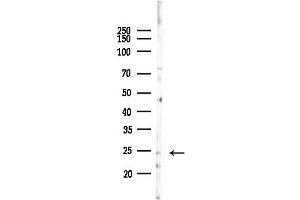 anti-Deoxythymidylate Kinase (Thymidylate Kinase) (DTYMK) (Internal Region) antibody
