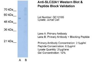 Host:  Rabbit  Target Name:  SLC22A1  Sample Type:  Jurkat  Lane A:  Primary Antibody  Lane B:  Primary Antibody + Blocking Peptide  Primary Antibody Concentration:  2. (SLC22A1 Antikörper  (N-Term))