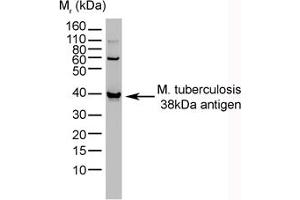 Image no. 1 for anti-Mycobacterium Tuberculosis, 38kDa antibody (ABIN304017) (Mycobacterium Tuberculosis, 38kDa Antikörper)