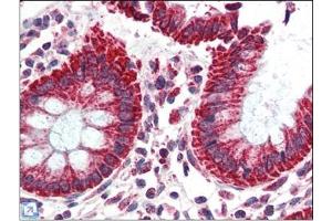 Human Colon (formalin-fixed, paraffin-embedded) stained with TSPOat 2. (TSPO Antikörper  (C-Term))