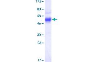 Image no. 1 for Advanced Glycosylation End Product-Specific Receptor (AGER) (AA 23-342) protein (His-DYKDDDDK-Strep II Tag) (ABIN1344554)