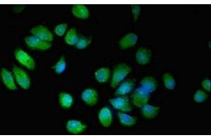 Immunofluorescent analysis of MCF-7 cells using ABIN7151962 at dilution of 1:100 and Alexa Fluor 488-congugated AffiniPure Goat Anti-Rabbit IgG(H+L) (EPN3 Antikörper  (AA 25-208))