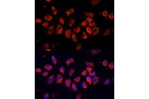 Immunofluorescence analysis of HeLa cells using SMO Polyclonal Antibody (ABIN6130715, ABIN6148140, ABIN6148141 and ABIN6220185) at dilution of 1:100 (40x lens). (SMO Antikörper  (AA 554-787))