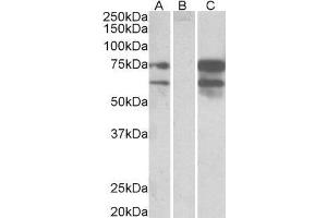 HEK293 lysate (10ug protein in RIPA buffer) overexpressing Human NRXN1 with DYKDDDDK tag probed with ABIN2564097 (0. (Neurexin 1 Antikörper  (C-Term))