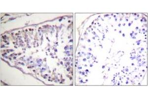 Immunohistochemistry (IHC) image for anti-Lipase, Hormone-Sensitive (LIPE) (AA 518-567) antibody (ABIN2888636) (LIPE Antikörper  (AA 518-567))