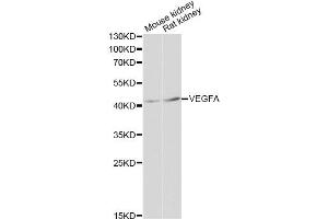Western blot analysis of extracts of various cell lines, using VEGFA antibody (ABIN5999168) at 1:3000 dilution. (VEGF Antikörper)