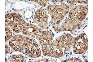 Immunohistochemical staining of paraffin-embedded Human Kidney tissue using anti-ALDOB mouse monoclonal antibody. (ALDOB Antikörper)