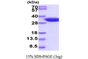 SDS-PAGE (SDS) image for Hydroxyprostaglandin Dehydrogenase 15-(NAD) (HPGD) (AA 1-269) protein (His tag) (ABIN5854804) (HPGD Protein (AA 1-269) (His tag))