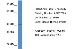 Western Blotting (WB) image for anti-PR Domain Containing 12 (PRDM12) (Middle Region) antibody (ABIN2787445) (PRDM12 Antikörper  (Middle Region))