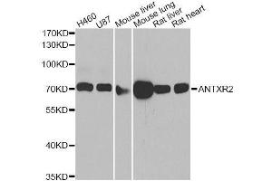 Western blot analysis of extracts of various cell lines, using ANTXR2 antibody. (ANTXR2 Antikörper  (AA 339-488))