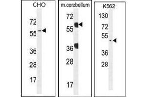 Western blot analysis of GTPBP2 Antibody (C-term) in CHO, K562 and mouse cerebellum cell line lysates (35ug/lane). (GTPBP2 Antikörper  (C-Term))