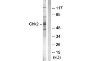 Western blot analysis of extracts from Jurkat cells, using Chk2 (Ab-387) Antibody. (CHEK2 Antikörper  (AA 361-410))