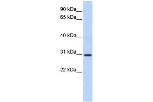 WB Suggested Anti-BCAS2 Antibody Titration:  0. (BCAS2 Antikörper  (N-Term))