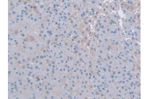 Immunohistochemistry (IHC) image for anti-Interferon gamma (IFNG) (AA 23-156) antibody (ABIN7429433)