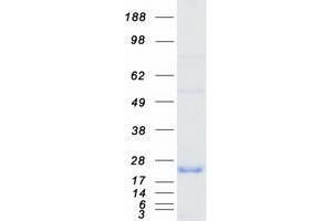 Western Blotting (WB) image for Protein Phosphatase Inhibitor 1 (PPP1R1A) protein (Myc-DYKDDDDK Tag) (ABIN2729478)