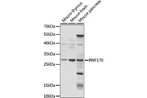 Western blot analysis of extracts of various cell lines, using RNF170 antibody (ABIN7270064) at 1:1000 dilution. (RNF170 Antikörper  (AA 46-120))