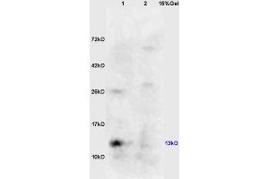 Lane 1: mouse kidney lysates Lane 2: mouse embryo lysates probed with Anti phospho-eIF4EBP1/4EBP1(Ser64) Polyclonal Antibody, Unconjugated (ABIN682963) at 1:200 in 4 °C. (eIF4EBP1 Antikörper  (pSer65))