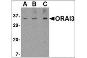 Western blot analysis of ORAI3 in A20 cell lysate with this product at (A) 1, (B) 2 and (C) 4 μg/ml. (ORAI3 Antikörper  (N-Term))