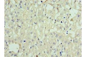 Immunohistochemistry of paraffin-embedded human liver tissue using ABIN7168634 at dilution of 1:100 (Sclerostin Antikörper  (AA 24-213))