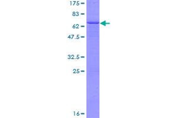 EPM2A Protein (AA 1-331) (GST tag)