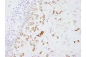 Immunohistochemistry (IHC) image for anti-Coronin, Actin Binding Protein, 1A (CORO1A) (AA 250-300) antibody (ABIN7448482)