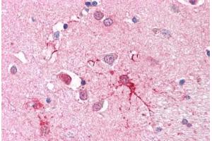 Human Brain, Basal Ganglia (SLC1A4 Antikörper  (C-Term))