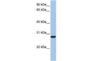 Western Blotting (WB) image for anti-Voltage-Dependent Anion Channel 3 (VDAC3) antibody (ABIN2458132)