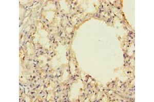 Immunohistochemistry of paraffin-embedded human lung tissue using ABIN7142685 at dilution of 1:100 (PRKRIR Antikörper  (AA 612-761))