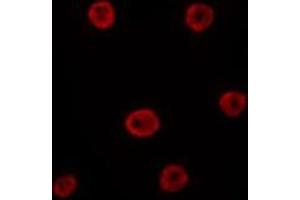 ABIN6275800 staining HepG2 by IF/ICC. (GATA6 Antikörper  (Internal Region))