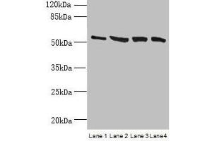 Western blot All lanes: CCDC112 antibody at 12 μg/mL Lane 1: Jurkat whole cell lysate Lane 2: Hela whole cell lysate Lane 3: HepG2 whole cell lysate Lane 4: A549 whole cell lysate Secondary Goat polyclonal to rabbit IgG at 1/10000 dilution Predicted band size: 54, 62 kDa Observed band size: 54 kDa (CCDC112 Antikörper  (AA 201-446))