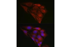 Immunofluorescence analysis of U2OS cells using BiP/GRP78 Rabbit pAb (ABIN6134514, ABIN6142042, ABIN6142044 and ABIN6215180) at dilution of 1:100 (40x lens).