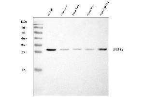 Western blot analysis of SNAIL/SNAI1 using anti-SNAIL/SNAI1 antibody (ABIN7599028). (SNAIL Antikörper  (AA 1-170))