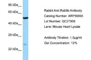 Western Blotting (WB) image for anti-RAB9B, Member RAS Oncogene Family (RAB9B) (N-Term) antibody (ABIN2786963) (RAB9B Antikörper  (N-Term))